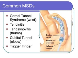 Common MSDs Carpal Tunnel  Syndrome (wrist) Tendinitis Tenosynovitis (thumb) Cubital Tunnel (elbow)  Trigger Finger 