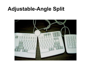 Adjustable-Angle Split
Keyboard
 