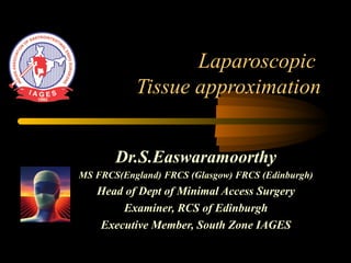 Laparoscopic
Tissue approximation
Dr.S.Easwaramoorthy
MS FRCS(England) FRCS (Glasgow) FRCS (Edinburgh)
Head of Dept of Minimal Access Surgery
Examiner, RCS of Edinburgh
Executive Member, South Zone IAGES
 