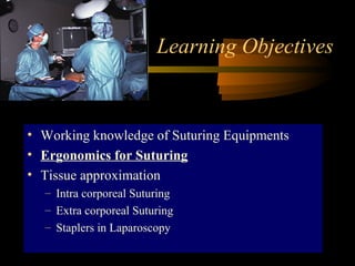 Learning Objectives
• Working knowledge of Suturing Equipments
• Ergonomics for Suturing
• Tissue approximation
– Intra corporeal Suturing
– Extra corporeal Suturing
– Staplers in Laparoscopy
 