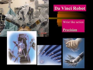Da Vinci Robot
Wrist like action
PrecisionPrecision
 