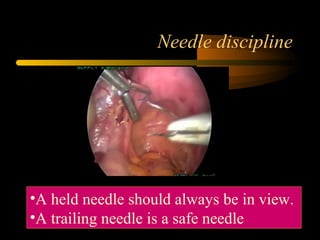 Needle discipline
•A held needle should always be in view.
•A trailing needle is a safe needle
 