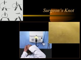 Surgeon’s Knot
 
