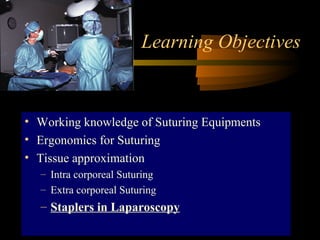 Learning Objectives
• Working knowledge of Suturing Equipments
• Ergonomics for Suturing
• Tissue approximation
– Intra corporeal Suturing
– Extra corporeal Suturing
– Staplers in Laparoscopy
 