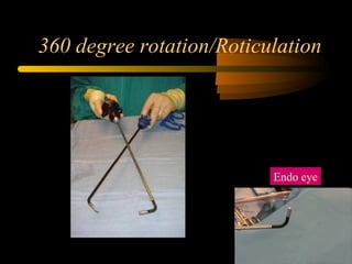 360 degree rotation/Roticulation
Endo eye
 