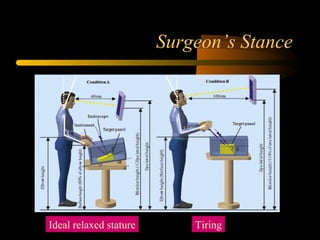 Surgeon’s Stance
Ideal relaxed stature Tiring
 