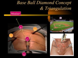 Base Ball Diamond Concept
& Triangulation
Monitor
S
C
R
L
P
 