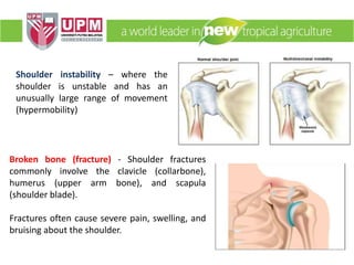 Shoulder instability – where the
shoulder is unstable and has an
unusually large range of movement
(hypermobility)
Broken bone (fracture) - Shoulder fractures
commonly involve the clavicle (collarbone),
humerus (upper arm bone), and scapula
(shoulder blade).
Fractures often cause severe pain, swelling, and
bruising about the shoulder.
 