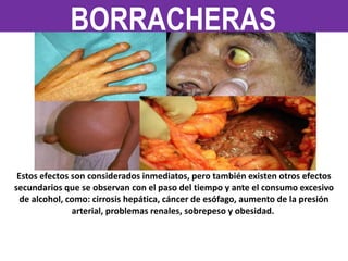Estos efectos son considerados inmediatos, pero también existen otros efectos
secundarios que se observan con el paso del tiempo y ante el consumo excesivo
de alcohol, como: cirrosis hepática, cáncer de esófago, aumento de la presión
arterial, problemas renales, sobrepeso y obesidad.
BORRACHERAS
 