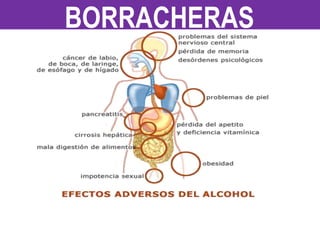 BORRACHERAS
 