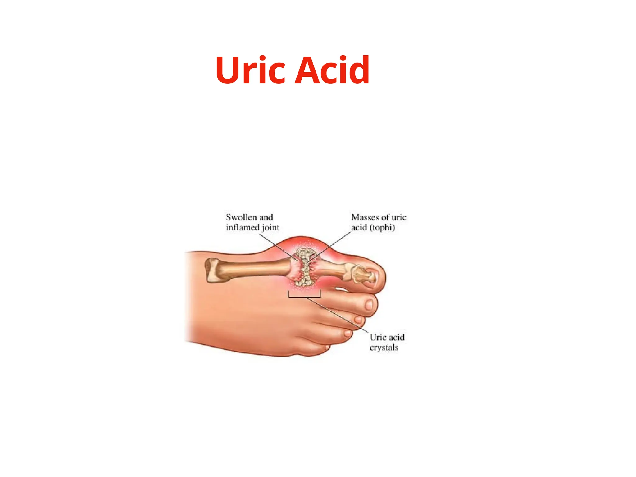 Uric Acid
 