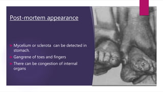 Post-mortem appearance
 Mycelium or sclerota can be detected in
stomach.
 Gangrene of toes and fingers
 There can be congestion of internal
organs
 