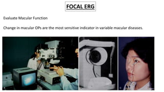 Electroretinogram and Clinical Applications | PPTX