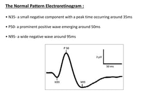 Electroretinogram and Clinical Applications | PPTX