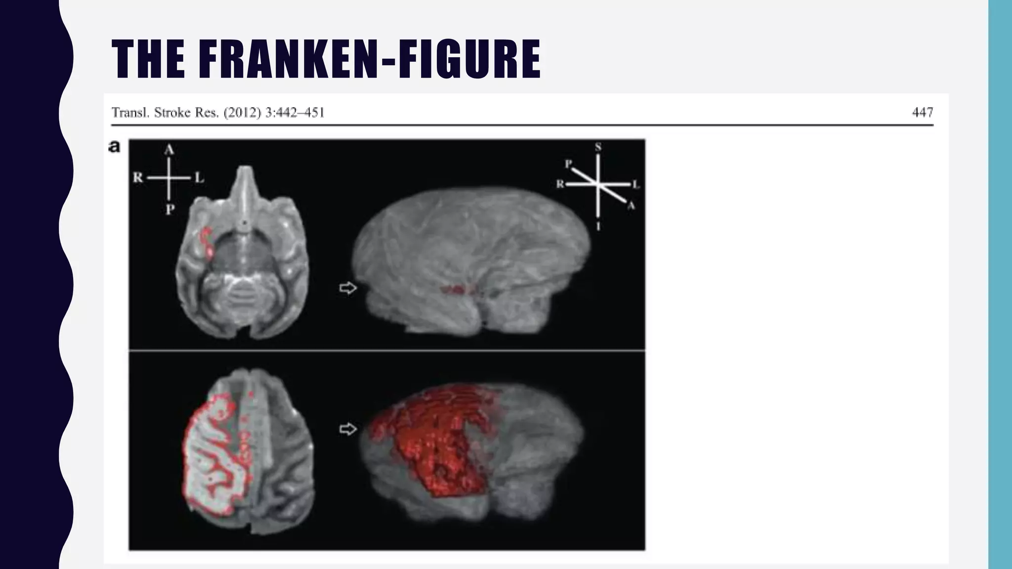 Neuroimaging Data Visualization Case Study - BioData Club 4/6/2018 | PPTX