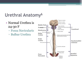 • Normal Urethra is
24-30 F
▫ Fossa Navicularis
▫ Bulbar Urethra
Urethral Anatomy6
Stratified
Squamous
Pseudostratified
Columnar
Transitional
Fossa
Navicularis
Penile
Urethra
Bulbar
Urethra
Membranous
Prostatic
Bladder Neck
 