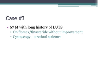 Case #3
• 67 M with long history of LUTS
▫ On flomax/finasteride without improvement
▫ Cystoscopy – urethral stricture
 