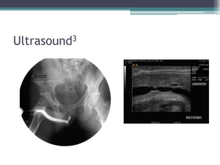 Ultrasound3
 