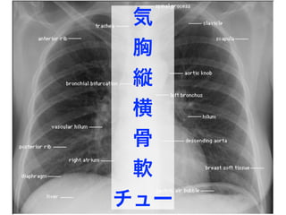 気
胸
縦
横
骨
軟
チュー
 
