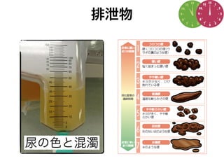尿の色と混濁
排泄物
 