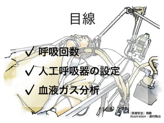 目線
呼吸回数
人工呼吸器の設定
血液ガス分析
 