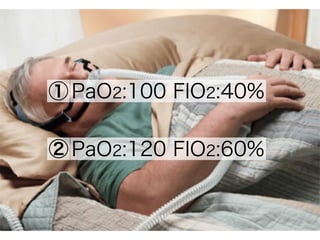 PaO2:100 FIO2:40%
PaO2:120 FIO2:60%
①
②
 