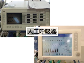 人工呼吸器
 