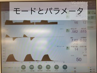 モードとパラメータ
 
