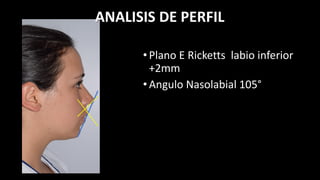 Erika caso clinico | PDF