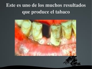   
Este es uno de los muchos resultados 
que produce el tabaco
.
 
