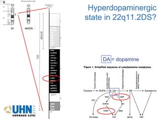 Erik Boot - Studying Psychosis in 22q11 Deletion Syndrome | PDF