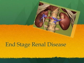 End Stage Renal Disease 
