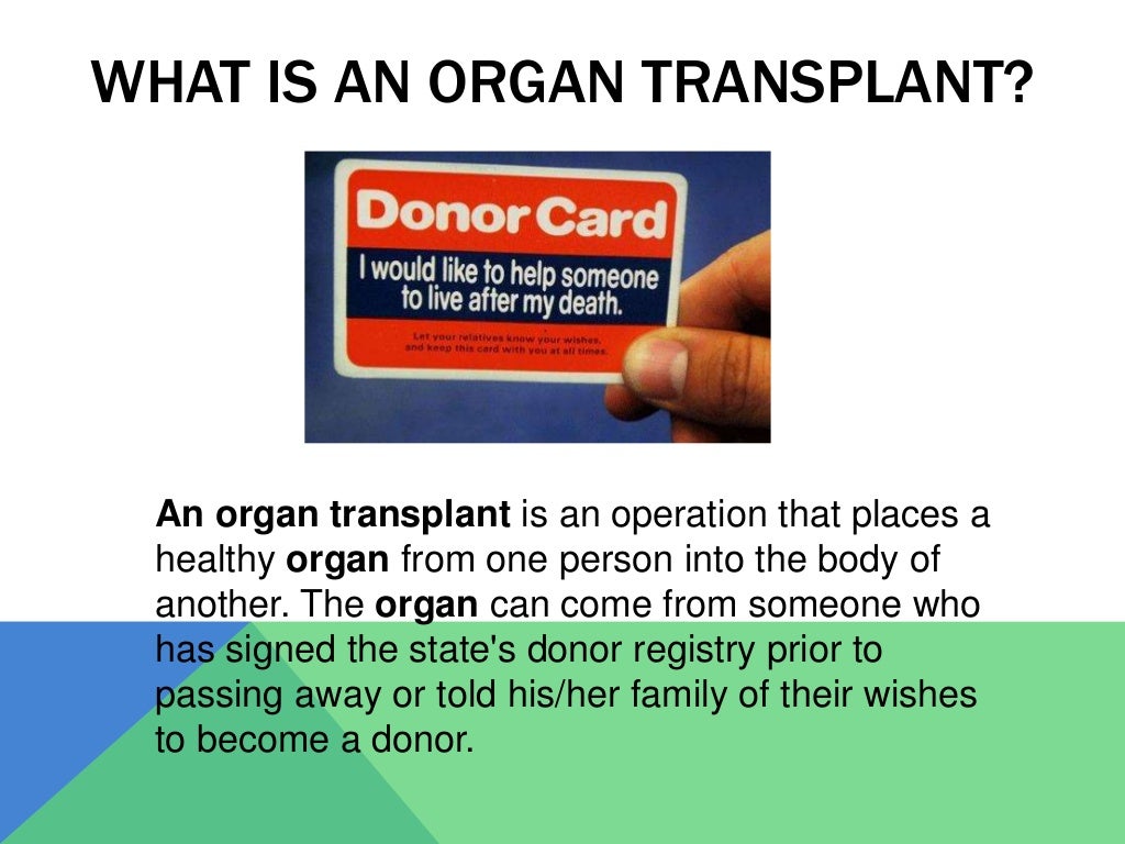 Organ transplant process image