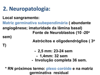 GMH/IVH :-
Local sangramento:
Matriz germinativa subependimária ( abundante
angiogênese; imaturidade da lâmina basal)
Fonte de Neuroblastos (10 -20a
sem)
Astrócitos e oligodendróglios ( 3o
T)
- 2,5 mm: 23-24 sem
- 1,4mm: 32 sem
- Involução completa 36 sem.
* RN próximos termo: plexo coróide e na matriz
germinativa residual
2. Neuropatologia:
 