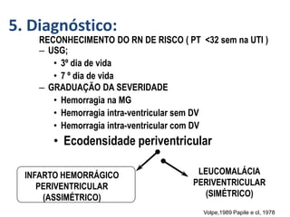 5. Diagnóstico:
RECONHECIMENTO DO RN DE RISCO ( PT <32 sem na UTI )
– USG;
• 3º dia de vida
• 7 º dia de vida
– GRADUAÇÃO DA SEVERIDADE
• Hemorragia na MG
• Hemorragia intra-ventricular sem DV
• Hemorragia intra-ventricular com DV
• Ecodensidade periventricular
LEUCOMALÁCIA
PERIVENTRICULAR
(SIMÉTRICO)
Volpe,1989 Papile e cl, 1978
INFARTO HEMORRÁGICO
PERIVENTRICULAR
(ASSIMÉTRICO)
 