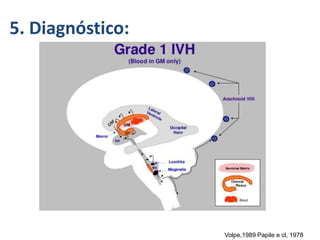 5. Diagnóstico:
Volpe,1989 Papile e cl, 1978
 