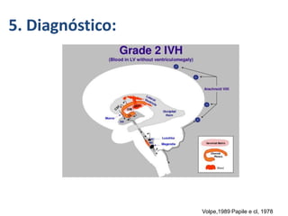 5. Diagnóstico:
Volpe,1989 Papile e cl, 1978
 