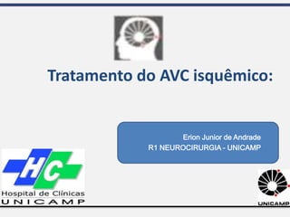 Erion Junior de Andrade
R1 NEUROCIRURGIA - UNICAMP
Tratamento do AVC isquêmico:
 