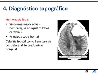 4. Diagnóstico topográfico
Hemorragia lobar
• Síndromes associadas a
hemorragias nos quatro lobos
cerebrais.
• Principal: Lobo frontal
Cefaléia frontal como hemiparesia
contralateral de predominio
braquial.
 