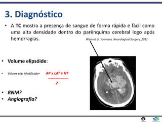 • A TC mostra a presença de sangue de forma rápida e fácil como
uma alta densidade dentro do parênquima cerebral logo após
hemorragias. Winn et al. Youmans Neurological Surgery, 2011
3. Diagnóstico
• Volume elipsóide:
• Volume elip. Modificado= AP x LAT x HT
----------------
2
• RNM?
• Angiografia?
 