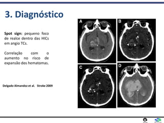 3. Diagnóstico
Spot sign: pequeno foco
de realce dentro das HICs
em angio TCs.
Correlação com o
aumento no risco de
expansão dos hematomas.
Delgado Almandoz et al. Stroke 2009
 