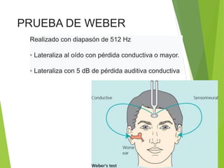 PRUEBA DE WEBER
Realizado con diapasón de 512 Hz
▫ Lateraliza al oído con pérdida conductiva o mayor.
▫ Lateraliza con 5 dB de pérdida auditiva conductiva
 