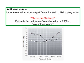 Audiometría tonal
La enfermedad muestra un patrón audiométrico clásico progresivo.
“Nicho de Carhartt”
Caída de la conducción ósea alrededor de 2000Hz
Dato patognomónico
 