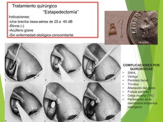 Tratamiento quirúrgico
“Estapedectomía”
Indicaciones:
-Una brecha ósea-aérea de 25 a 40 dB
-Rinne (-)
-Acúfeno grave
-Sin enfermedad otológica concomitante
COMPLICACIONES POS
QUIRÚRGICAS
• SNHL
• Vértigo
• Parálisis facial
• Tinnitus
• Alteración del gusto
• Fístula perilinfa
• Oreja muerta (1%)
• Perforación de la
membrana timpánica
yatrógena
 