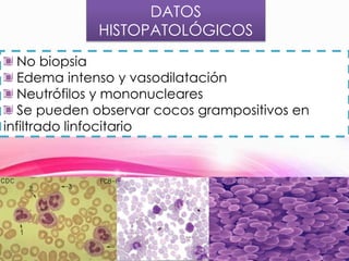 DATOS
HISTOPATOLÓGICOS
No biopsia
Edema intenso y vasodilatación
Neutrófilos y mononucleares
Se pueden observar cocos grampositivos en
infiltrado linfocitario

 
