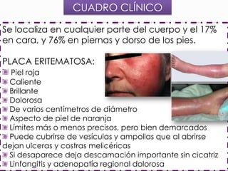 CUADRO CLÍNICO
Se localiza en cualquier parte del cuerpo y el 17%
en cara, y 76% en piernas y dorso de los pies.
PLACA ERITEMATOSA:
Piel roja
Caliente
Brillante
Dolorosa
De varios centímetros de diámetro
Aspecto de piel de naranja
Límites más o menos precisos, pero bien demarcados
Puede cubrirse de vesículas y ampollas que al abrirse
dejan ulceras y costras melicéricas
Si desaparece deja descamación importante sin cicatriz
Linfangitis y adenopatía regional dolorosa

 
