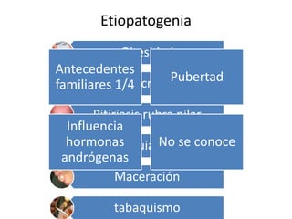 Etiopatogenia
Obesidad
Acné
Pitiriasis rubra pilar
Paquioniquia congénita
Maceración
tabaquismo
Antecedentes
familiares 1/4
Pubertad
Influencia
hormonas
andrógenas
No se conoce
 