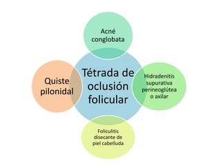 Tétrada de
oclusión
folicular
Acné
conglobata
Hidradenitis
supurativa
perineoglútea
o axilar
Foliculitis
disecante de
piel cabelluda
Quiste
pilonidal
 