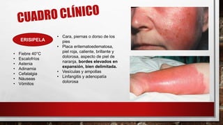 ERISIPELA
• Cara, piernas o dorso de los
pies
• Placa eritematoedematosa,
piel roja, caliente, brillante y
dolorosa, aspecto de piel de
naranja, bordes elevados en
expansión, bien delimitada.
• Vesículas y ampollas
• Linfangitis y adenopatía
dolorosa
• Fiebre 40°C
• Escalofríos
• Astenia
• Adinamia
• Cefalalgia
• Náuseas
• Vómitos
 
