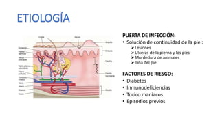 ETIOLOGÍA
PUERTA DE INFECCIÓN:
• Solución de continuidad de la piel:
Lesiones
Ulceras de la pierna y los pies
Mordedura de animales
Tiña del pie
FACTORES DE RIESGO:
• Diabetes
• Inmunodeficiencias
• Toxico maniacos
• Episodios previos
 